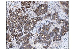 IHC analysis of AS160/TBC1D4 using anti-AS160/TBC1D4 antibody (ABIN7599745). (TBC1D4 anticorps  (AA 1118-1298))