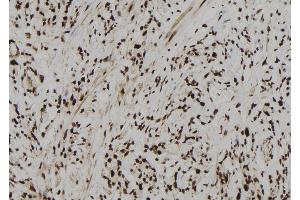 ABIN6273104 at 1/100 staining Human gastric tissue by IHC-P. (CPSF4 anticorps  (C-Term))