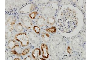 Immunoperoxidase of monoclonal antibody to TIMP2 on formalin-fixed paraffin-embedded human kidney. (TIMP2 anticorps  (AA 27-220))