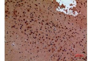 Immunohistochemistry (IHC) analysis of paraffin-embedded Mouse Brain, antibody was diluted at 1:100.