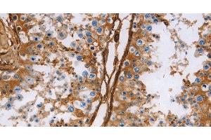 Immunohistochemistry of paraffin-embedded Human testis using Caldesmon Polyclonal Antibody at dilution of 1:40