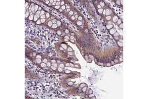 Immunohistochemical staining of human rectum with CACNG8 polyclonal antibody  shows moderate cytoplasmic positivity in glandular cells. (CACNG8 anticorps)