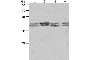 Western Blot analysis of Hela, 293T, NIH/3T3 and Jurkat cell using PSMD6 Polyclonal Antibody at dilution of 1:650 (PSMD6 anticorps)