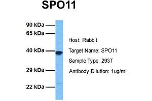 Host: Rabbit Target Name: SPO11 Sample Tissue: Human 293T Antibody Dilution: 1. (SPO11 anticorps  (N-Term))
