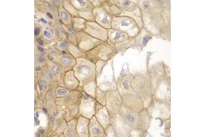 Immunohistochemistry of paraffin-embedded human esophageal using IL7R antibody at dilution of 1:100 (40x lens). (IL7R anticorps)