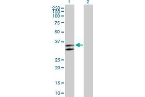 Western Blot analysis of SERPINC1 expression in transfected 293T cell line by SERPINC1 MaxPab polyclonal antibody. (SERPINC1 anticorps  (AA 1-259))