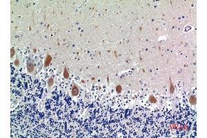 Immunohistochemical analysis of paraffin-embedded human-brain, antibody was diluted at 1:100 (KIR3DL1 anticorps  (N-Term))