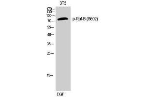 Western Blotting (WB) image for anti-B-Raf proto-oncogene, serine/threonine kinase (BRAF) (pSer602) antibody (ABIN3180448) (BRAF anticorps  (pSer602))