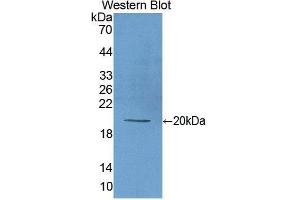 Western Blotting (WB) image for anti-Matrix Metallopeptidase 9 (Gelatinase B, 92kDa Gelatinase, 92kDa Type IV Collagenase) (MMP9) antibody (FITC) (ABIN1173111) (MMP 9 anticorps  (FITC))