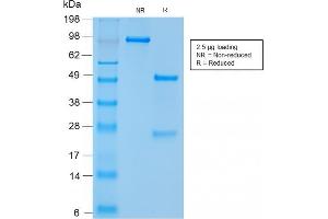 SDS-PAGE Analysis Purified CD56 Rabbit Recombinant Monoclonal Antibody (NCAM1/2217R). (Recombinant CD56 anticorps)