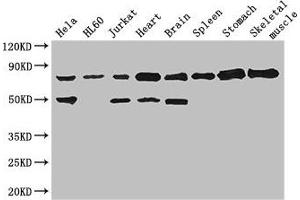 Western Blot Positive WB detected in: Hela whole cell lysate, HL60 whole cell lysate, Jurkat whole cell lysate, Mouse heart tissue, Mouse brain tissue, Mouse spleen tissue, Mouse stomach tissue, Mouse skeletal muscle tissue All lanes: SENP1 antibody at 2. (SENP1 anticorps  (AA 63-214))