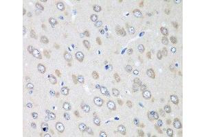 Immunohistochemistry of paraffin-embedded Rat brain using RPN2 Polyclonal Antibody at dilution of 1:100 (40x lens). (Ribophorin II anticorps)