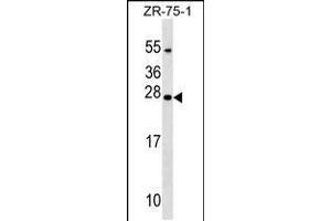 Western blot analysis in ZR-75-1 cell line lysates (35ug/lane). (NXNL1 anticorps  (AA 94-121))