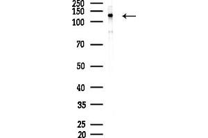 Western blot analysis of lysates from MDA-MB-231 cells(heat-shock,45 min treatment), using POM121 Antibody at 1/1000 dilution.