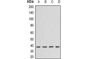 Western blot analysis of CK2 alpha expression in K562 (A), Hela (B), mouse testis (C), mouse brain (D) whole cell lysates. (CSNK2A1/CK II alpha anticorps)