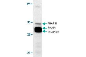 Western blot analysis of ANP32A expression in human Raji cell lysate with ANP32A polyclonal antibody  at 1 ug/mL . (PHAP1 anticorps  (N-Term))