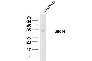SIRT4 anticorps  (AA 51-150)