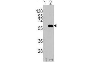 Image no. 2 for anti-CD4 (CD4) (N-Term) antibody (ABIN357033) (CD4 anticorps  (N-Term))