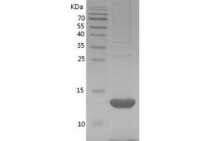 Western Blotting (WB) image for Serum Amyloid A1 (SAA1) (AA 18-122) protein (His tag) (ABIN7125061)