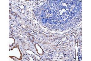 IHC analysis of MT-ND5 using anti-MT-ND5 antibody (ABIN7600145). (MT-ND5 anticorps  (AA 154-570))