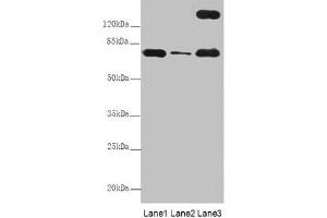Western Blot All lanes: TTC12 antibody at 8 μg/mL Lane 1: Mouse large intestine tissue Lane 2: Mouse small intestine tissue Lane 3: HepG2 whole cell lysate Secondary Goat polyclonal to rabbit IgG at 1/10000 dilution Predicted band size: 79, 82 kDa Observed band size: 79, 170 kDa (TTC12 anticorps  (AA 1-260))