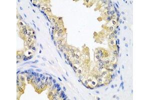 Immunohistochemistry of paraffin-embedded Human prostate using SPINT2 Polyclonal Antibody at dilution of 1:200 (40x lens). (SPINT2 anticorps)