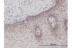Immunoperoxidase of purified MaxPab antibody to TAF7 on formalin-fixed paraffin-embedded human esophagus.