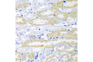 Immunohistochemistry of paraffin-embedded mouse kidney using FABP6 antibody (ABIN5974154) at dilution of 1/200 (40x lens). (FABP6 anticorps)