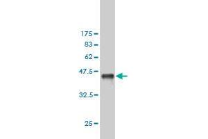 Western Blot detection against Immunogen (36. (Exportin 2 anticorps  (AA 872-971))