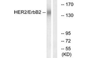 Western blot analysis of extracts from HuvEc cells, using HER2 (Ab-686) Antibody. (ErbB2/Her2 anticorps  (AA 661-710))