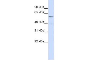 WB Suggested Anti-ZNF419 Antibody Titration:  0. (ZNF419 anticorps  (N-Term))