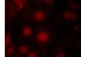 Immunofluorescence staining of methanol-fixed MCF7 cells using AFX(Phospho-Ser197) Antibody.