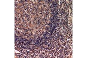 Immunohistochemical analysis of IDH3 alpha staining in human lymph gland formalin fixed paraffin embedded tissue section. (IDH3A anticorps)