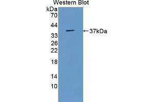 Western blot analysis of the recombinant protein. (MPST anticorps  (AA 1-297))