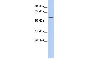 WB Suggested Anti-TBC1D10C Antibody Titration: 0. (Carabin anticorps  (N-Term))