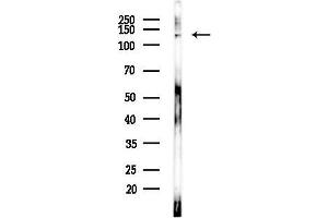 anti-Atrophin 1 (ATN1) (N-Term) antibody