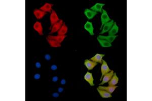 RNF87 Antibody staining Hela cells by IF/ICC. (TRIM4 anticorps)
