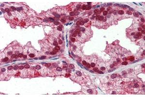 Human Prostate; Immunohistochemistry with Human Prostate lysate tissue at an antibody concentration of 5. (NFIX anticorps  (Middle Region))