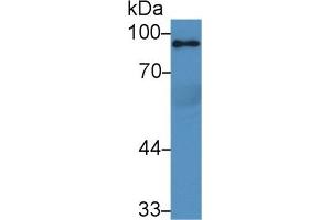 Detection of PPARgC1a in Rat Serum using Polyclonal Antibody to Peroxisome Proliferator Activated Receptor Gamma Coactivator 1 Alpha (PPARgC1a) (PPARGC1A anticorps  (AA 588-773))
