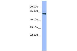 WB Suggested Anti-CYP4A22 Antibody Titration:  0.