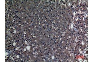 Immunohistochemistry (IHC) analysis of paraffin-embedded Human Liver, antibody was diluted at 1:100.