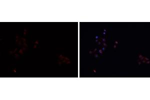 ABIN6276742 staining HEPG2 cells by IF/ICC. (SCARB1 anticorps  (Internal Region))