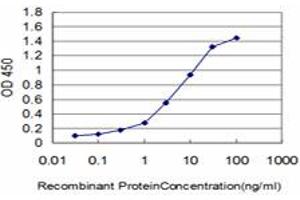 anti-Homeobox C10 (HOXC10) (AA 158-257) antibody