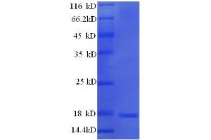 SDS-PAGE (SDS) image for Major Urinary Protein 19 (MUP19) (AA 32-181) protein (His tag) (ABIN5711071)