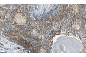 ABIN6274151 at 1/100 staining Human prostate tissue by IHC-P.