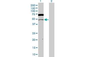 Western Blot analysis of CSNK2A1 expression in transfected 293T cell line by CSNK2A1 MaxPab polyclonal antibody. (CSNK2A1/CK II alpha anticorps  (AA 1-391))