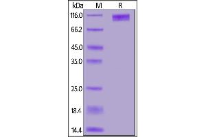 Cynomolgus GUCY2C, Fc Tag on  under reducing (R) condition. (GUCY2C Protein (AA 24-430) (Fc Tag))