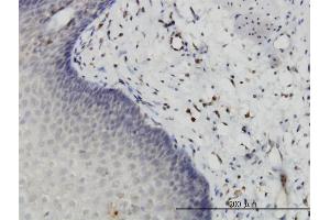Immunoperoxidase of monoclonal antibody to HIPK2 on formalin-fixed paraffin-embedded human esophagus. (HIPK2 anticorps  (AA 961-1065))