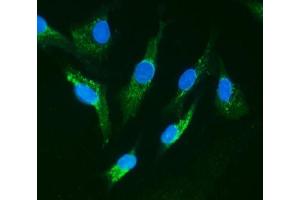 IF analysis of IRAK1 using anti-IRAK1 antibody (ABIN5693122).
