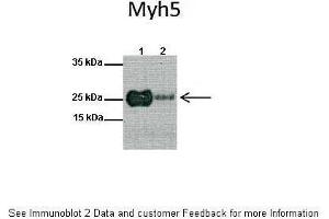 Lanes:   1: Mouse heart lysate, 2: Mouse skeletal muscle lysate  Primary Antibody Dilution:   1:1000  Secondary Antibody:   Anti-rabbit HRP  Secondary Antibody Dilution:   1:10000  Gene Name:   MYF5  Submitted by:   Anonymous (MYF5 anticorps  (N-Term))
